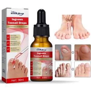 Uñas encarnadas Tr-e a t-me-nt-30ML1 fl oz encarnadas para uñas encarnadas, kit R-e-mo-val para uñas encarnadas para un fácil recorte, herramientas Uñas encarnadas Tr-e a t-me-nt-30ML1 fl oz encarnadas para uñas encarnadas, kit R-e-mo-val para uñas encarnadas para un fácil recorte, herramientas