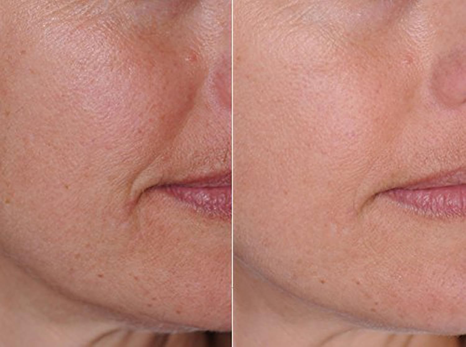 DNA CODE- Organic Argan Oil DayNight Wrinke Reduce Cream, wArgireline, M3000, Apple Stem Cell, Hyaluronic Acid