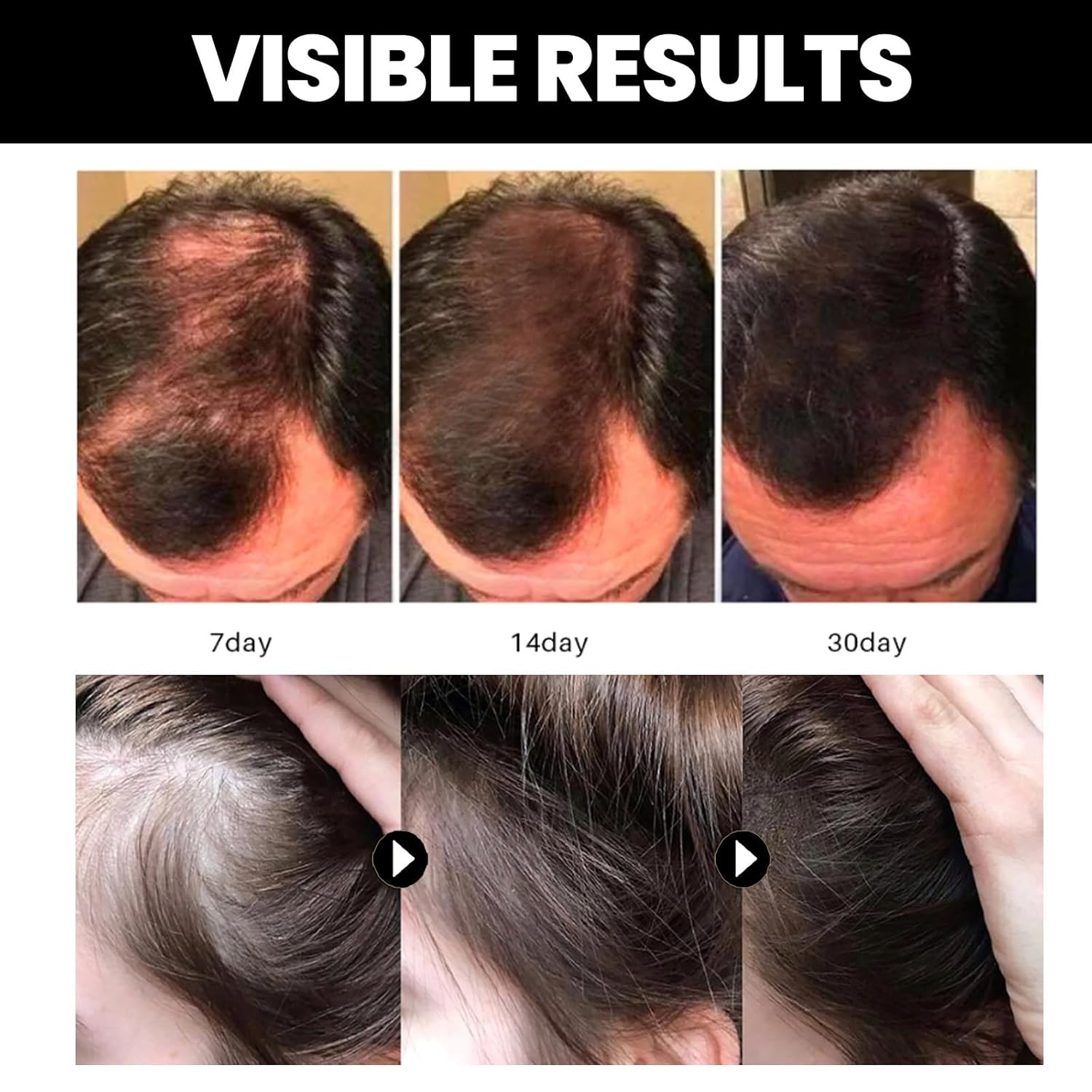 Aceite de batana, aceite de batana para el crecimiento del cabello, para el cabello, para promover la salud del cabello y mejorar el brillo del