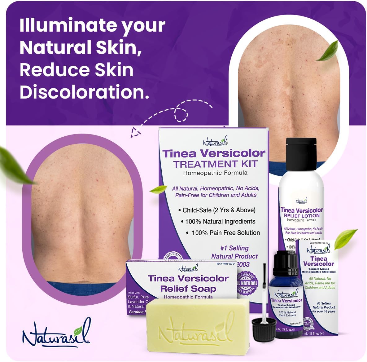 Naturasil Natural Treatment Tinea Versicolor - Jabón 10 de azufre También ayuda a aliviar la candida y la onicomicosis Barra de 4 onzas Paquete - Imagen 8