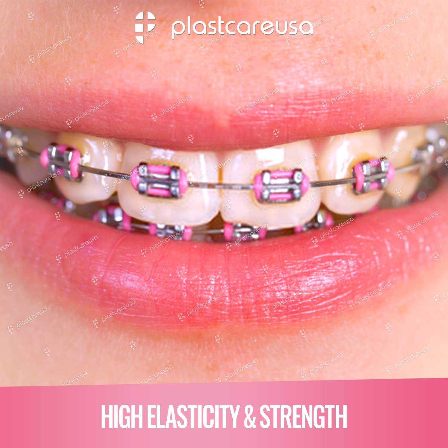 2080 Lazos de ligadura rosa para aparatos ortopédicos – Bridas de ligadura de ortodoncia dental para soportes – Bandas elásticas de goma con junta