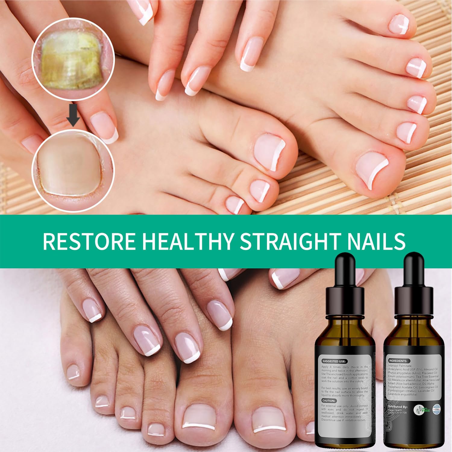 Tratamiento de uñas de metanail, tratamiento de crecimiento de uñas para tratamiento de uñas de los pies, extra fuerte para reparar uñas dañadas y