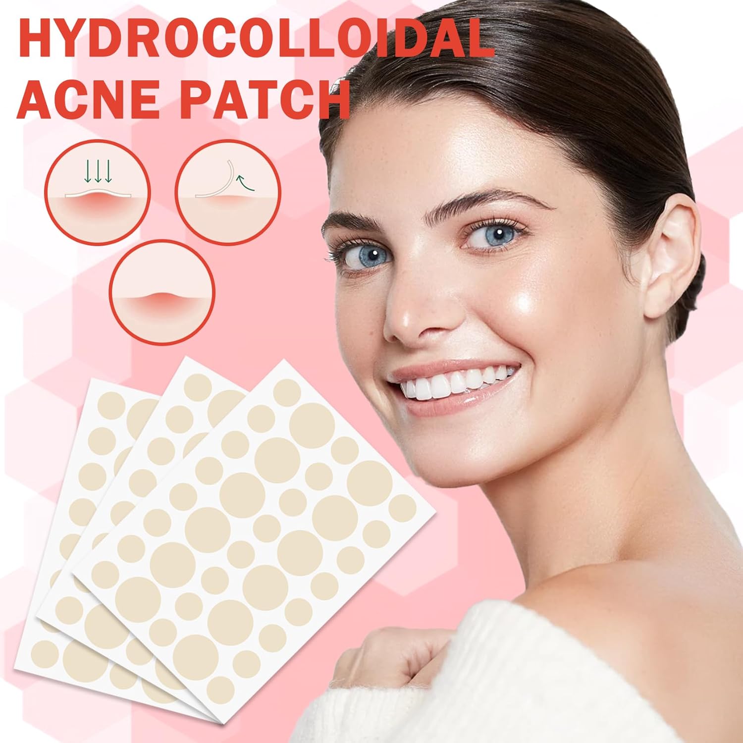 Parches hidrocoloides para cubrir el acné, parche de espinillas para acné, parches hidrocoloides para absorber el acné, calcomanías curativas para