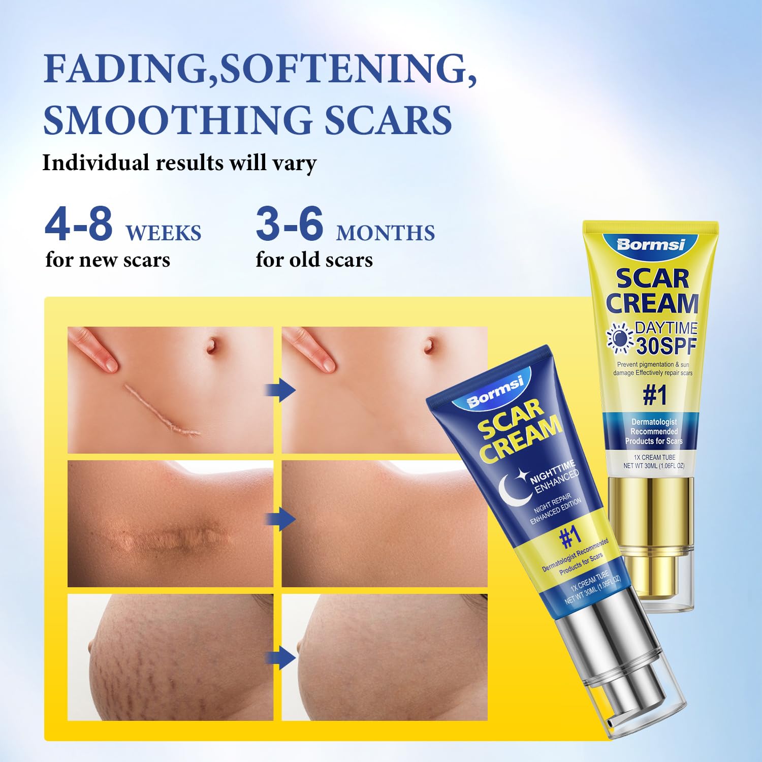 BORMSI Crema para cicatrices, protector solar SPF 30 y PM gel intensivo de silicona para cicatrices durante la noche, reduce la apariencia de