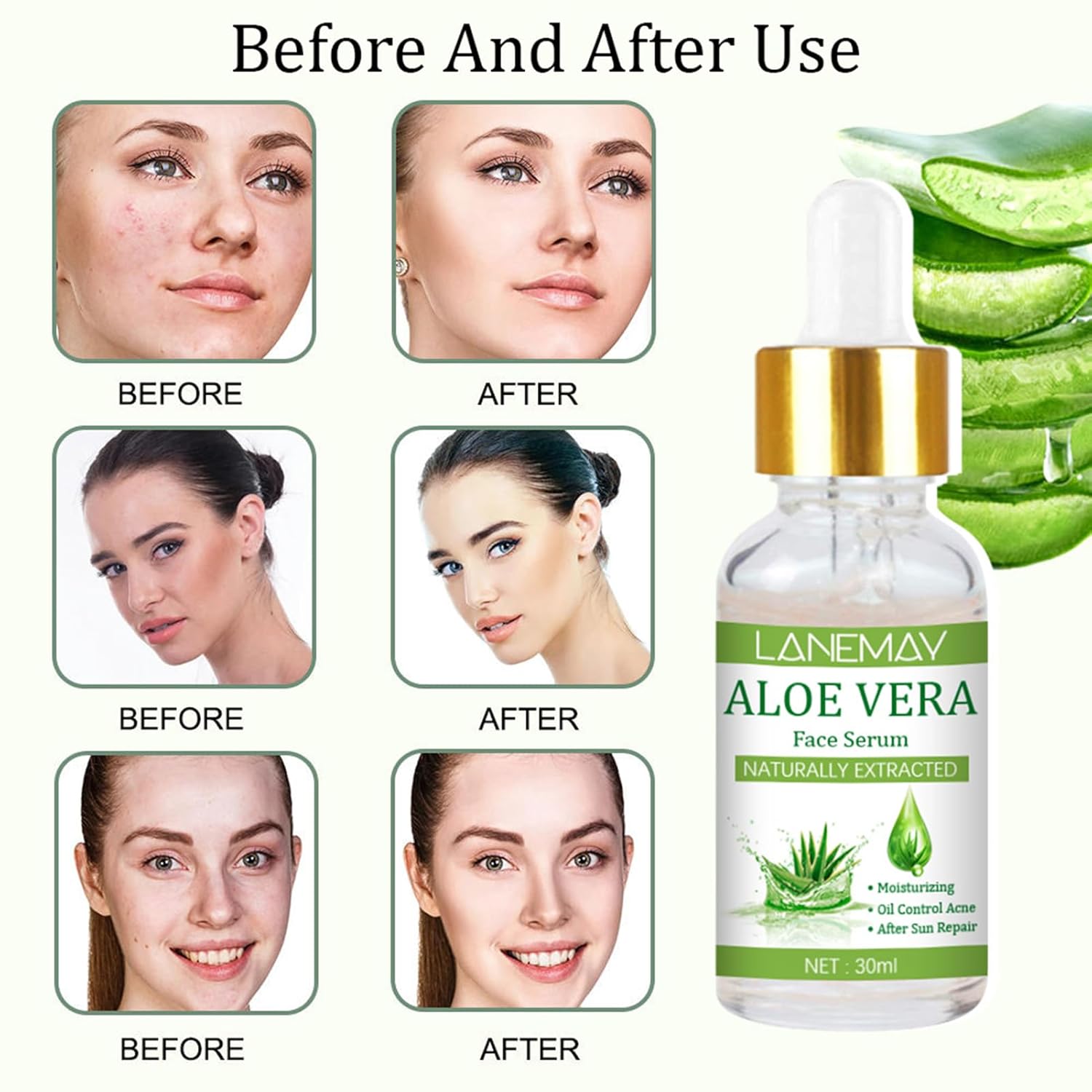 Suero facial de 1.0 fl oz, loción facial para productos de cuidado de la piel profunda y liviana, esencia facial para cuello, piel facial y codos