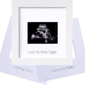 eletecpro Marco de fotos de ultrasonido, para pantalla de fotos de ecografía de 3 x 4, marcos de fotos de sonograma para anuncio de embarazo, eletecpro Marco de fotos de ultrasonido, para pantalla de fotos de ecografía de 3 x 4, marcos de fotos de sonograma para anuncio de embarazo,