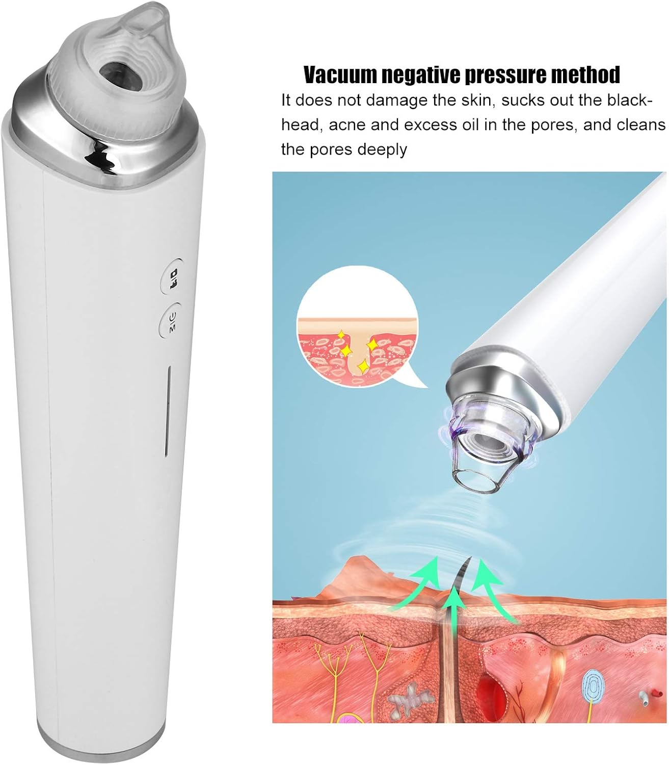 Aspiradora eliminadora de puntos negros, limpiador eléctrico de poros facial 2021, herramienta extractor de acné recargable por USB, kit de