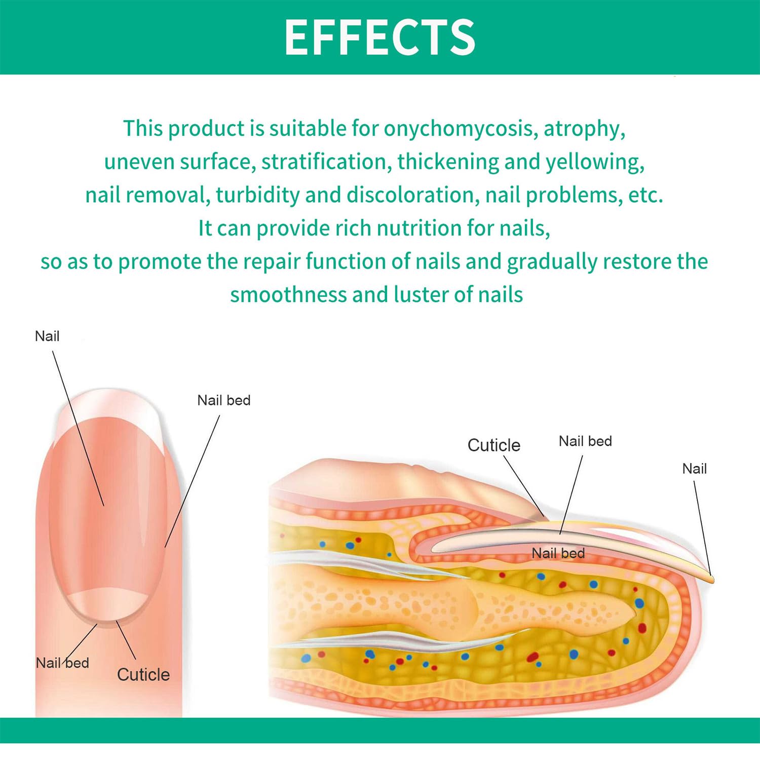 Tratamiento de uñas de metanail, tratamiento de crecimiento de uñas para tratamiento de uñas de los pies, extra fuerte para reparar uñas dañadas y