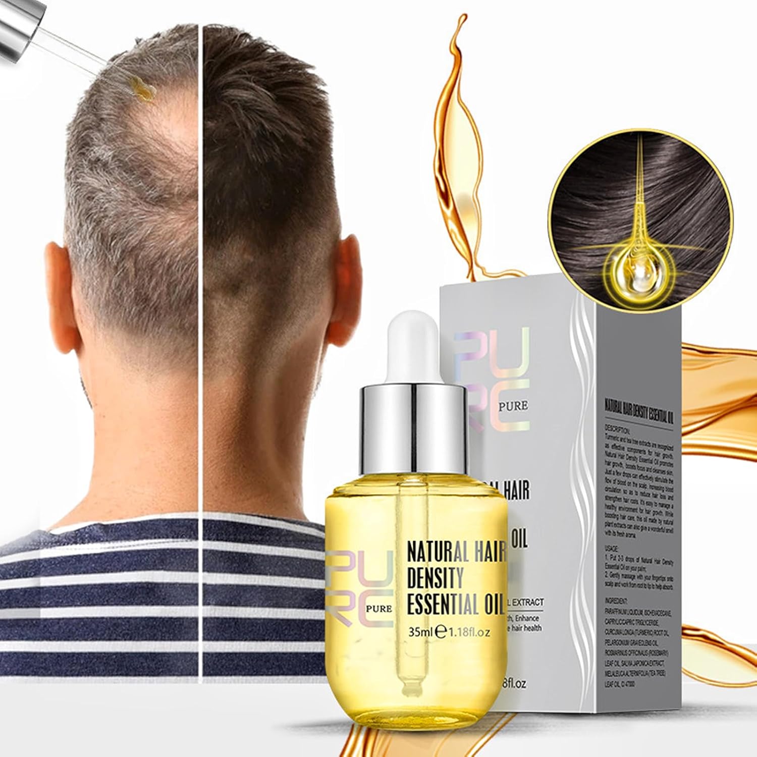 Sofmild Aceite esencial para el crecimiento del cabello, juego de cepillos para el cabello con suero para el crecimiento del cabello para cabello