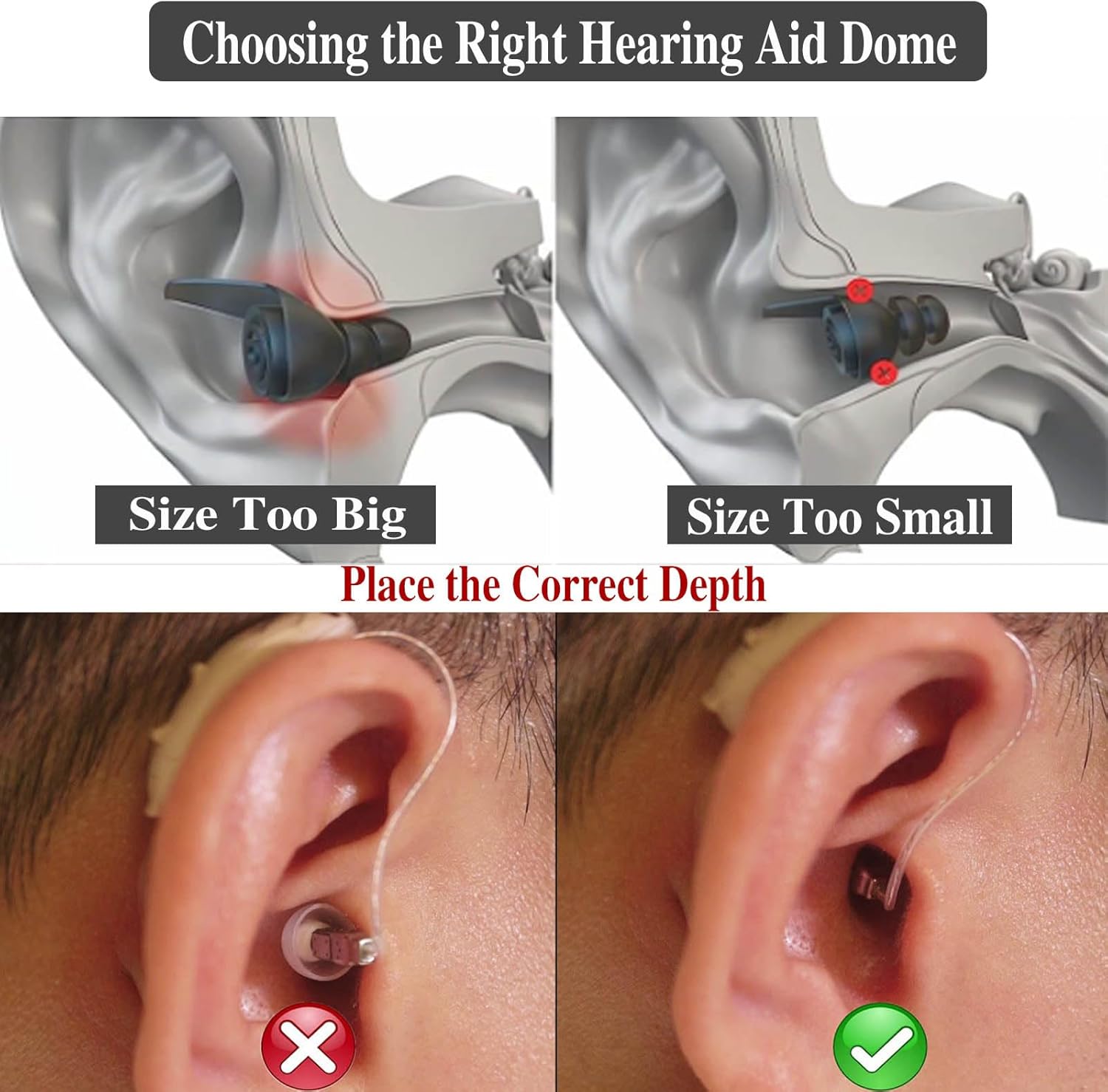 Starkey – Paquete de 30 cúpulas para audífonos Starkey Open Oticon, tamaño pequeño, compatible con los modelos Phonak Marvel & Paradise RIC BTE SDS