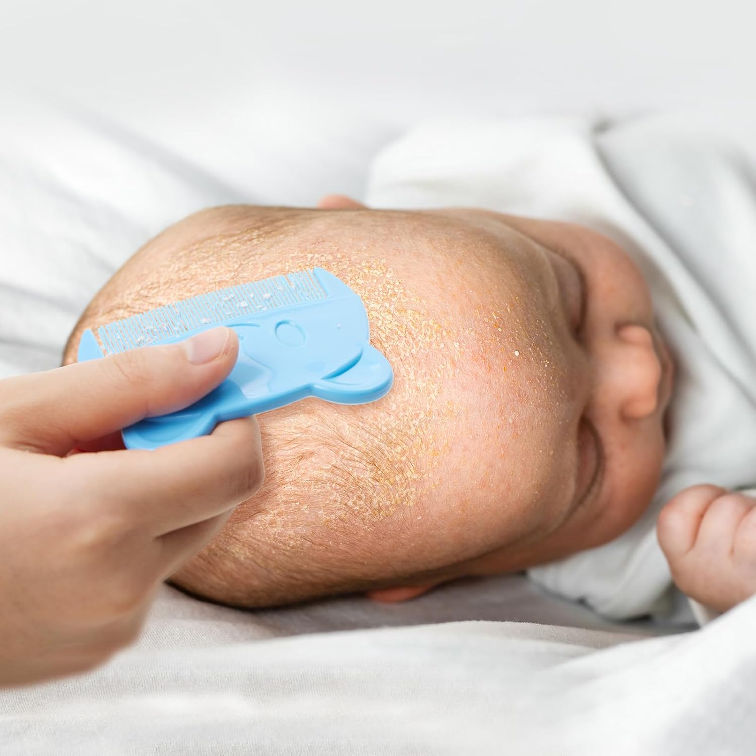 Lupantte Juego de baño para bebé, esenciales para piel seca, tapa de cuna y eczema, incluye cepillo de silicona para cuna, cepillo para cuero