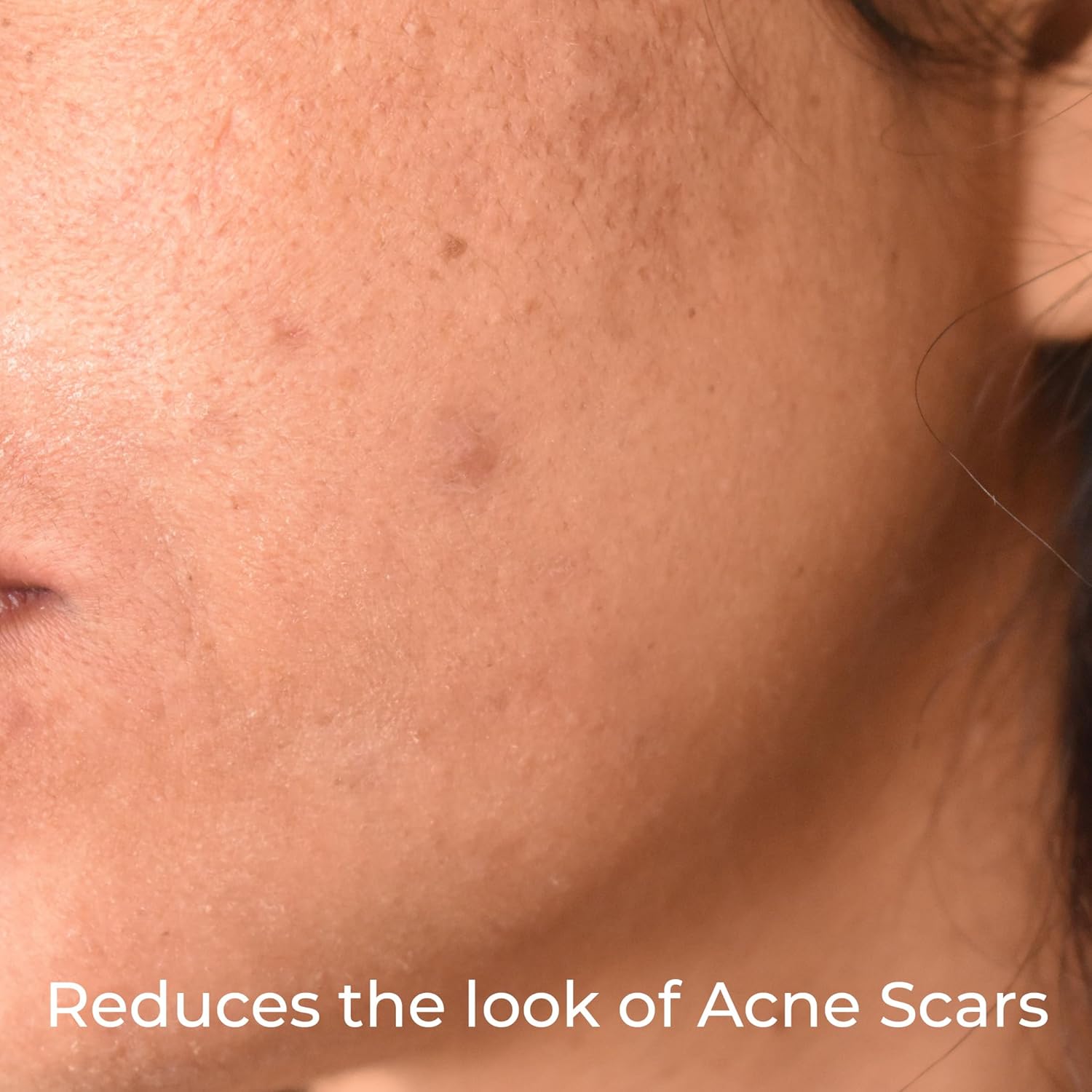 Mascarilla facial de cúrcuma con vitamina C para manchas oscuras e hiperpigmentación  Niacinamida  Probióticos