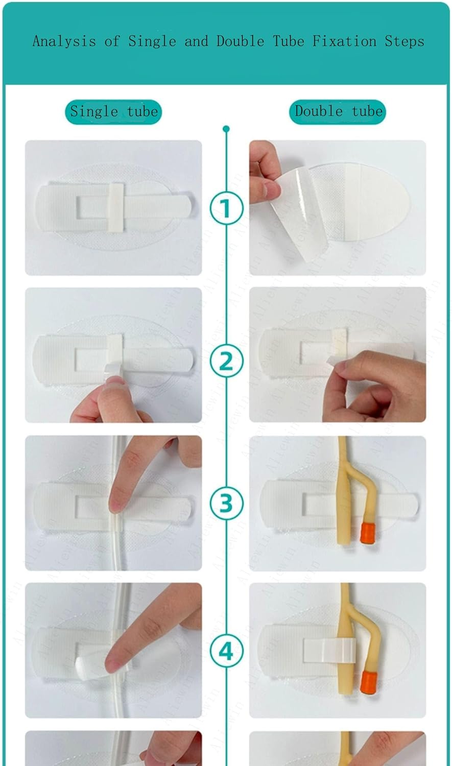 Dispositivo de estabilización de catéter, soporte para bolsa de catéter, soporte de banda para piernas de catéter, adhesivo de fijación de tubo