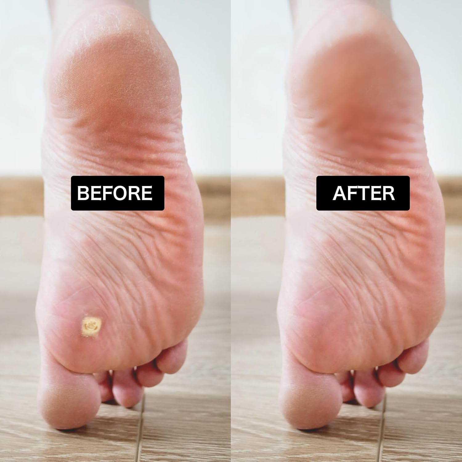 Broca de pedicura, broca de carburo de diamante para uñas, acero inoxidable, profesional, pedicura, callos de pie, lijado, brocas de pulido para
