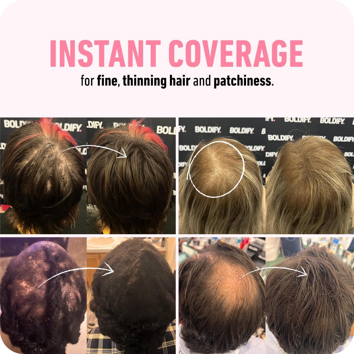 BOLDIFY – Fibras de pelo para el cabello fino (rubio claro), indetectables, botella de 2 onzas oculta completamente la pérdida de cabello en 15