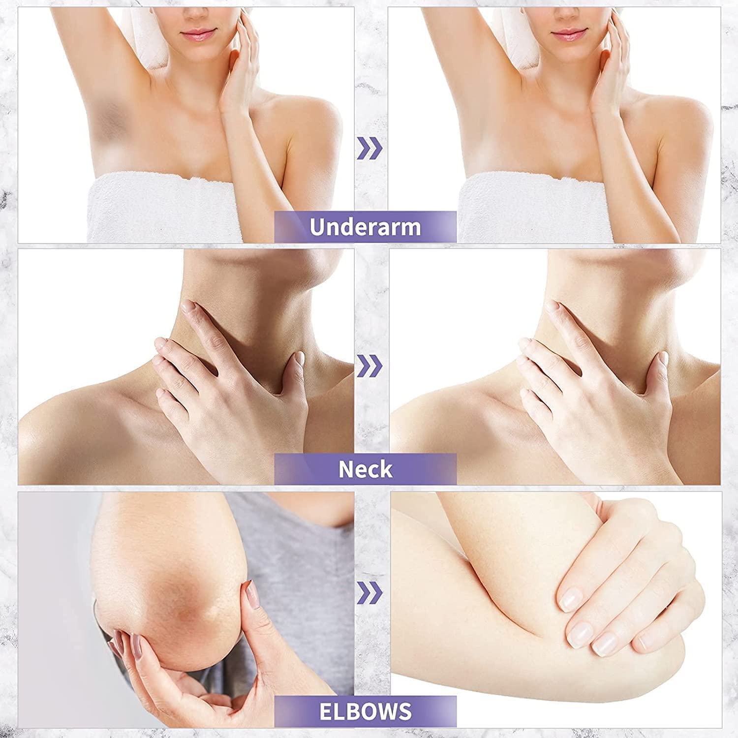 Acclyd – Crema corrector de manchas oscuras para el cuerpo, áreas íntimas, axilas, axilas, rodillas, piernas, codos y muslos internos, crema