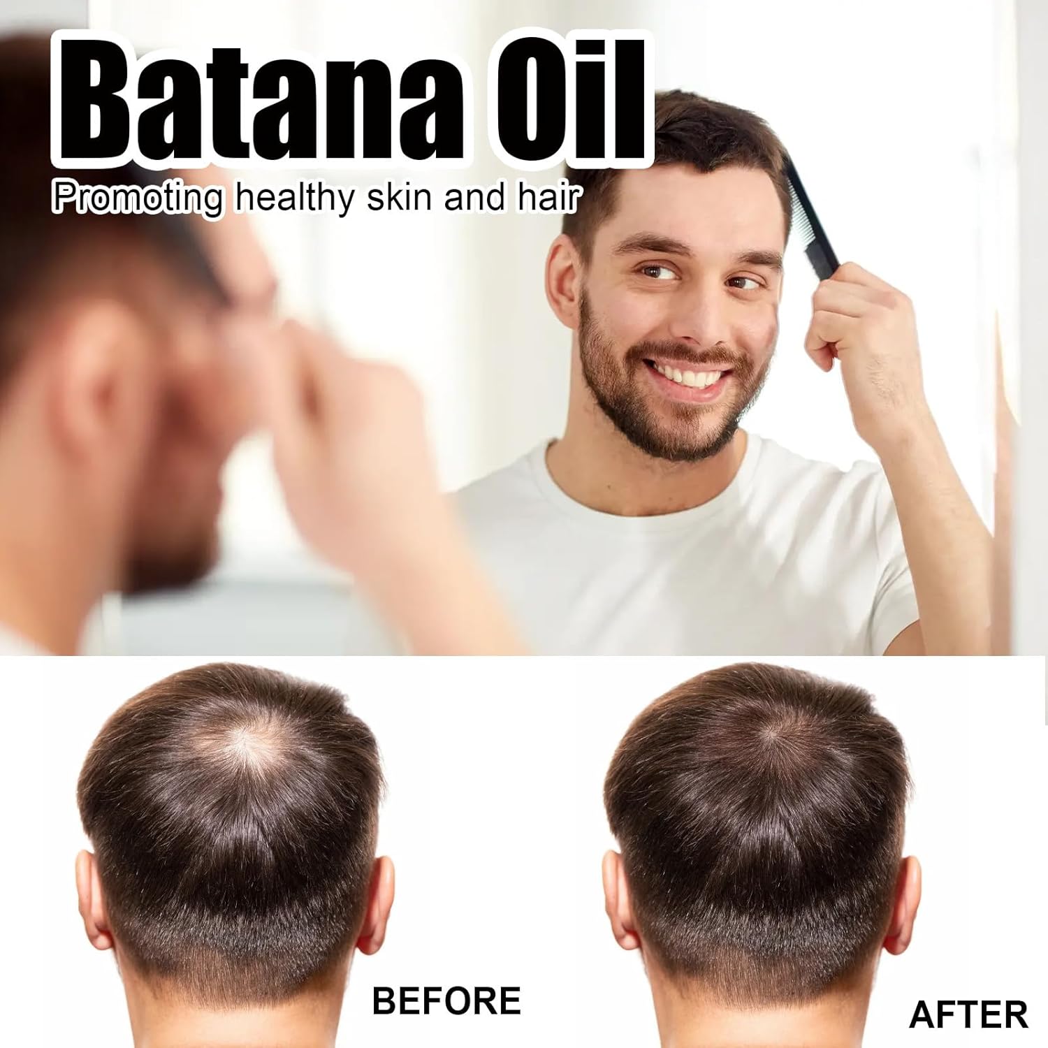 Aceite de batana, aceite de batana para el crecimiento del cabello, para el cabello, para promover la salud del cabello y mejorar el brillo del