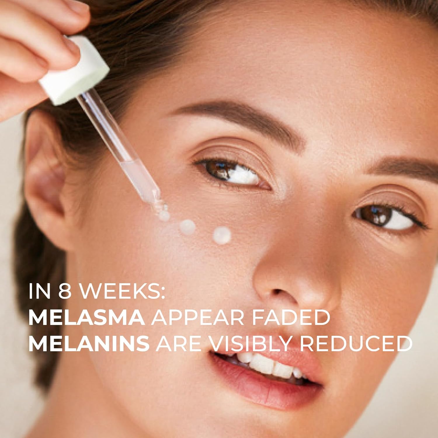 Abera Tratamiento de melasma para cara, removedor de manchas oscuras de melasma, suero corrector de manchas oscuras con juego de 5 máscaras para
