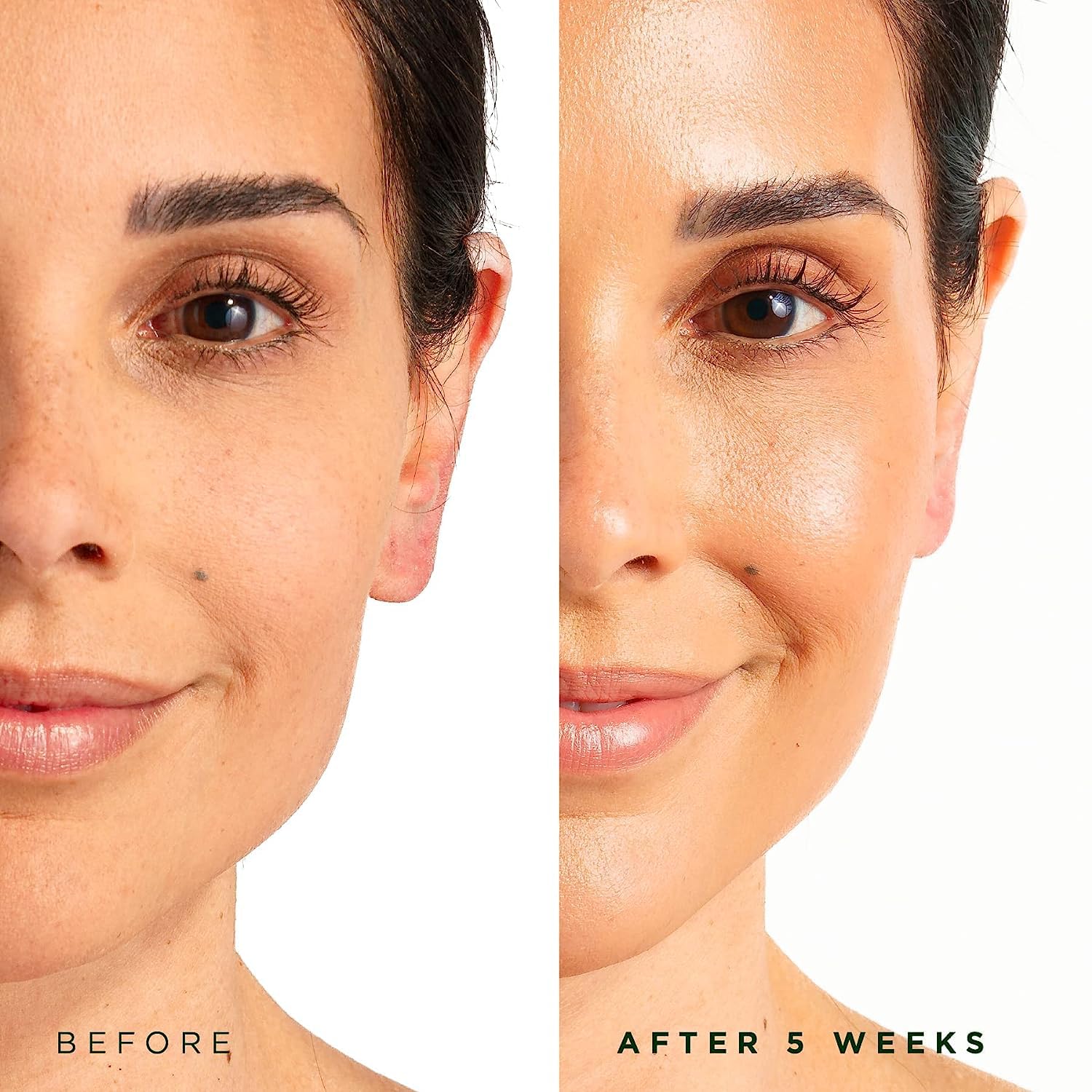 Tree of Life – Suero facial súper 20% de vitamina C+, 1 onza líquida, 1 paquete de sueros, vitamina E para iluminar y suavizar la piel secasensible,