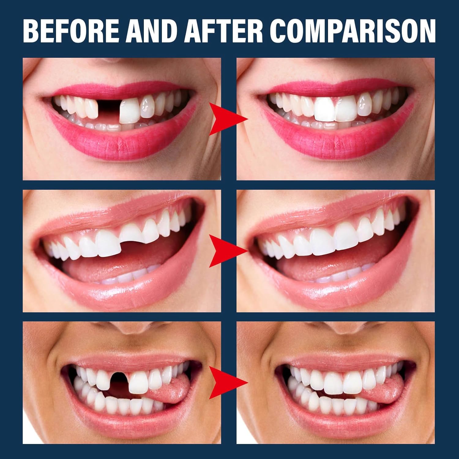 120 piezas de carillas de corona de dientes falsos, parte delantera, trasera, anterior y molar posteriores, con reparación de dientes, cuentas