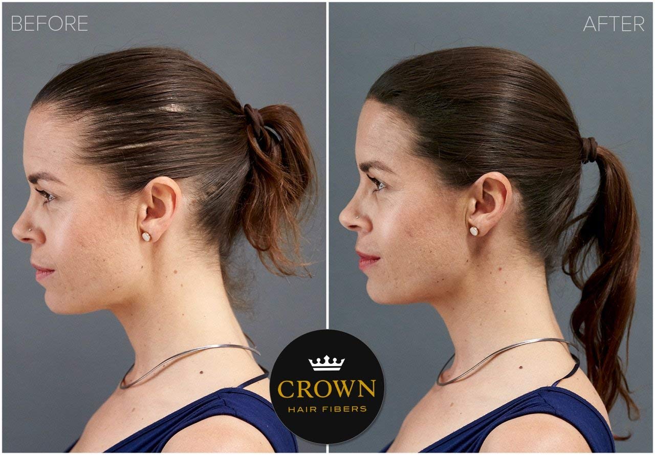 para cabello adelgazante (GRAY)  Espesa instantáneamente el cabello adelgazante o calvo para hombres y mujeres  Botella de 0.87 oz25 g  El mejor
