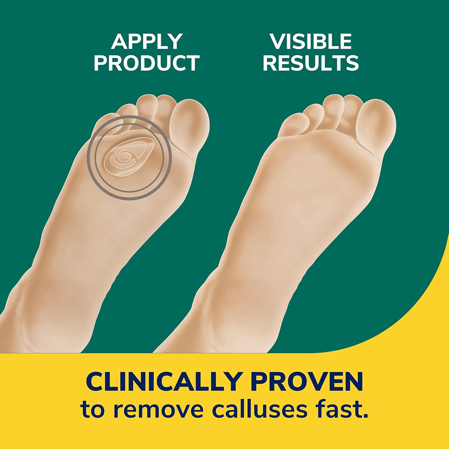 Dr. Scholl’s Duragel Removedor de callos 12 unidades