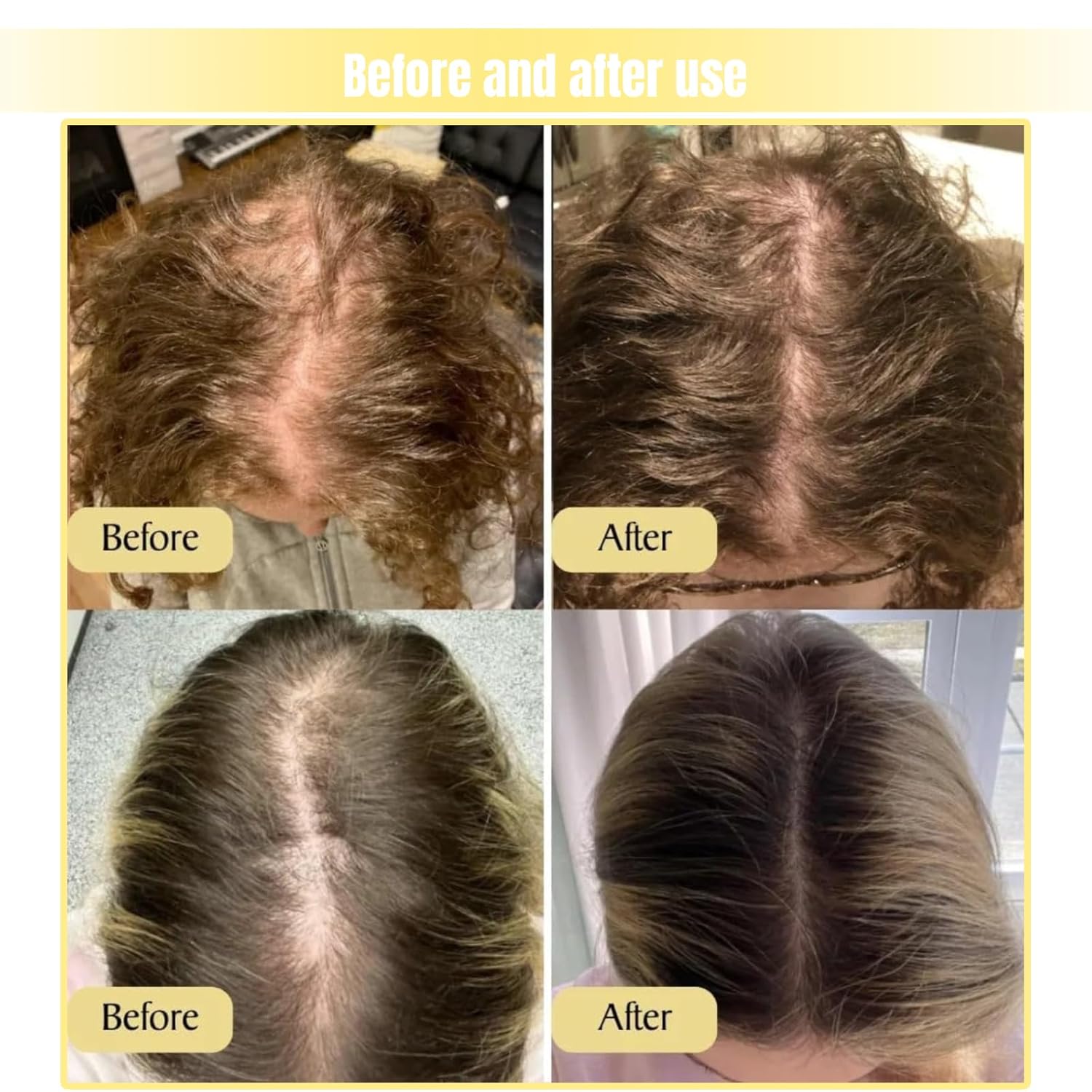 Carvenchi – Aceite natural para el crecimiento del cabello, vegano orgánico para mujeres y hombres, nutritivo para cabello encrespado seco (5