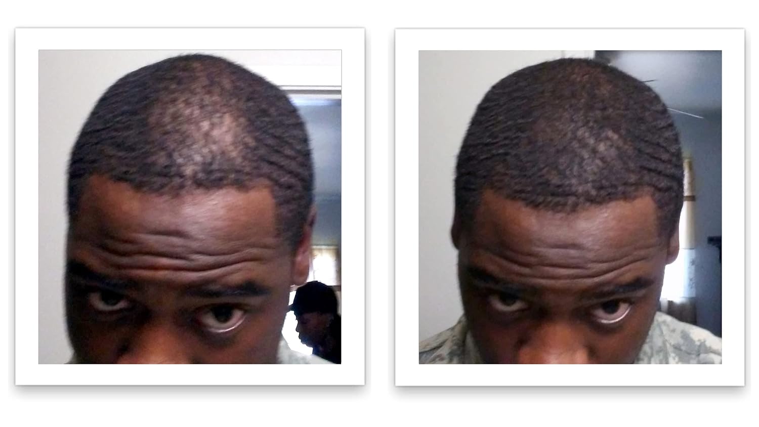 Oculta puntos calvos y bordes calvos al instante. Haz que el cabello fino se vea 10 veces más lleno. Kit de inicio de fibra capilar Caboki (negro)