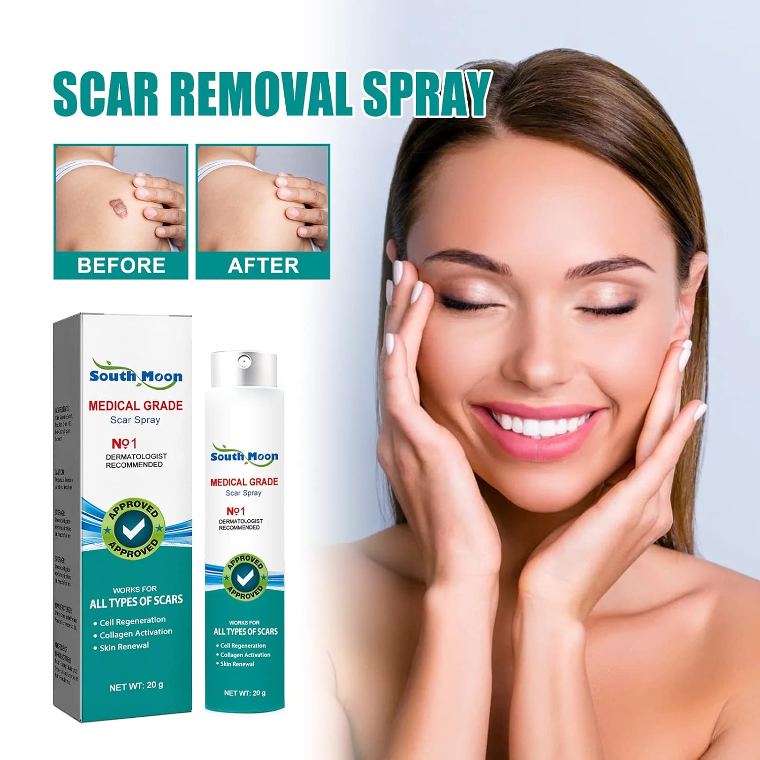 South Moon – Spray de cicatrices de grado médico, Scarremove Advanced Cicatrices Spray, spray médico para eliminar cicatrices, spray de cicatrices