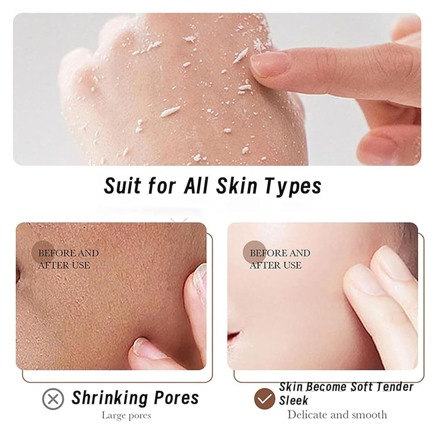 IVYDREVER Exfoliante De Arroz Para Aclarar La Piel, Exfoliante De Arroz Para Blanquear, Exfoliante De Arroz Para El Cuerpo Aclarador, Gel Exfoliante