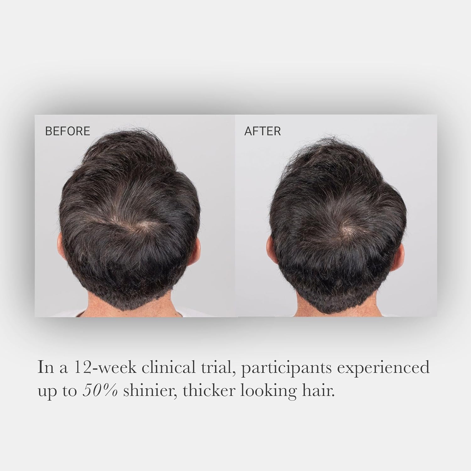 NULASTIN Tratamiento de suero vibrante para el cuero cabelludo y la barba para hombre con Elastaplex para un cabello más grueso, de aspecto más