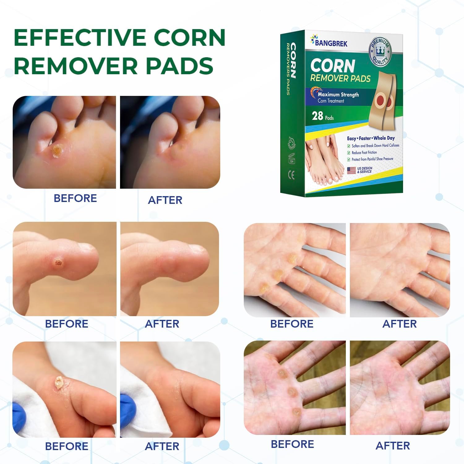 Removedor de maíz, removedor de maíz para pies extra fuerte, removedor de maíz de máxima resistencia para dedos de los pies, ingredientes