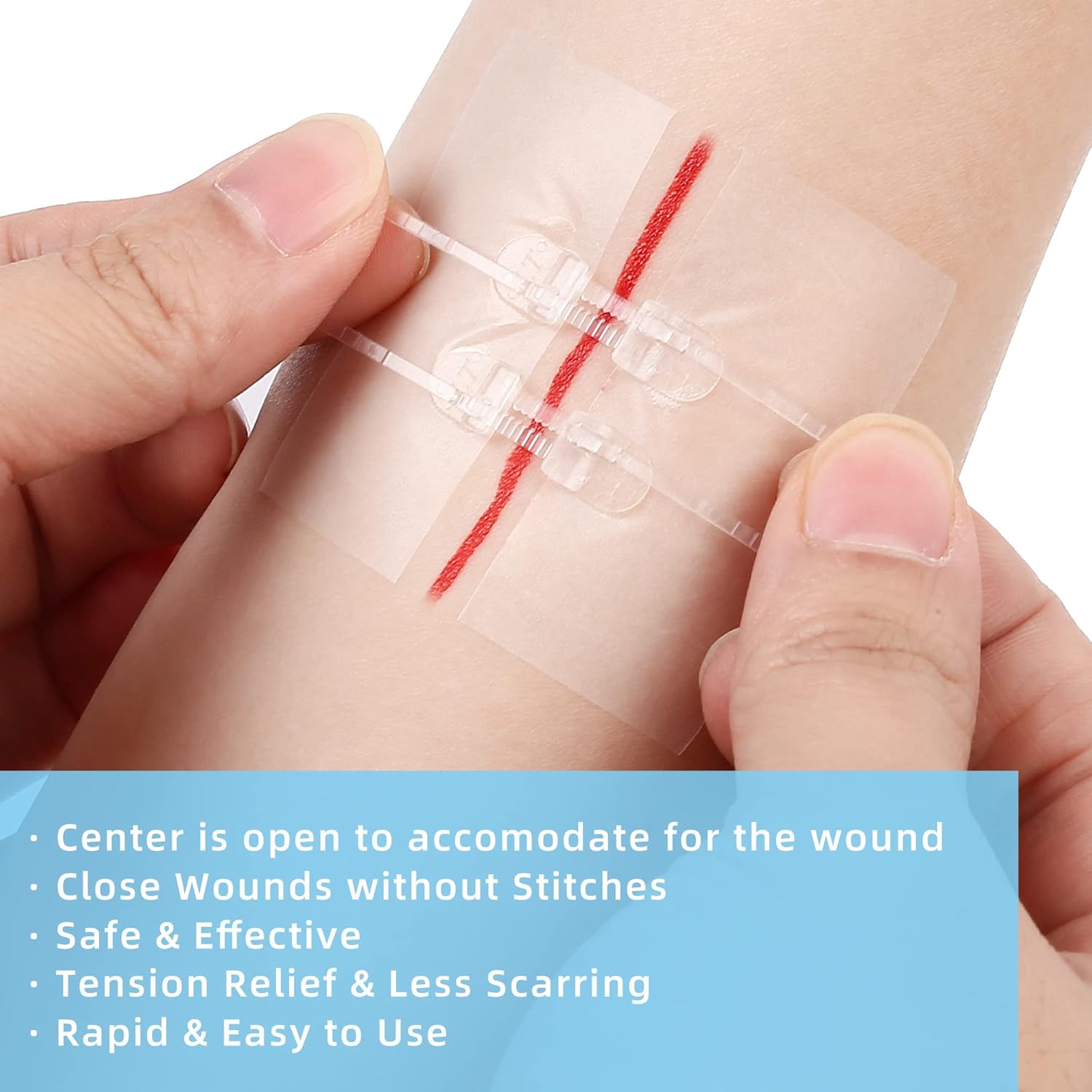 LotFancy Cierres de heridas de emergencia, 4 unidades, suministros de primeros auxilios, vendas médicas de mariposa, kit de reparación de laceración