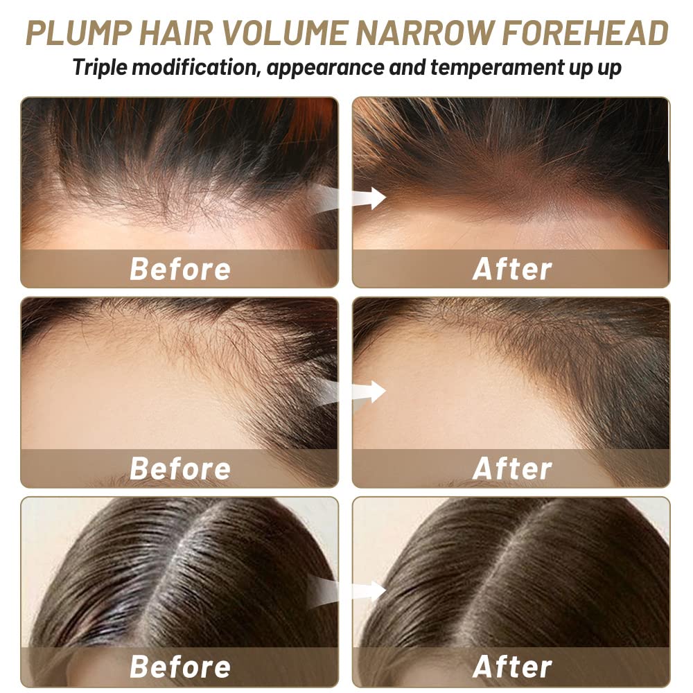 Polvo de retoque de raíz, polvo de cabello al instante para adelgazar la línea capilar para cubrir la línea capilar y oculta la pérdida de cabello,