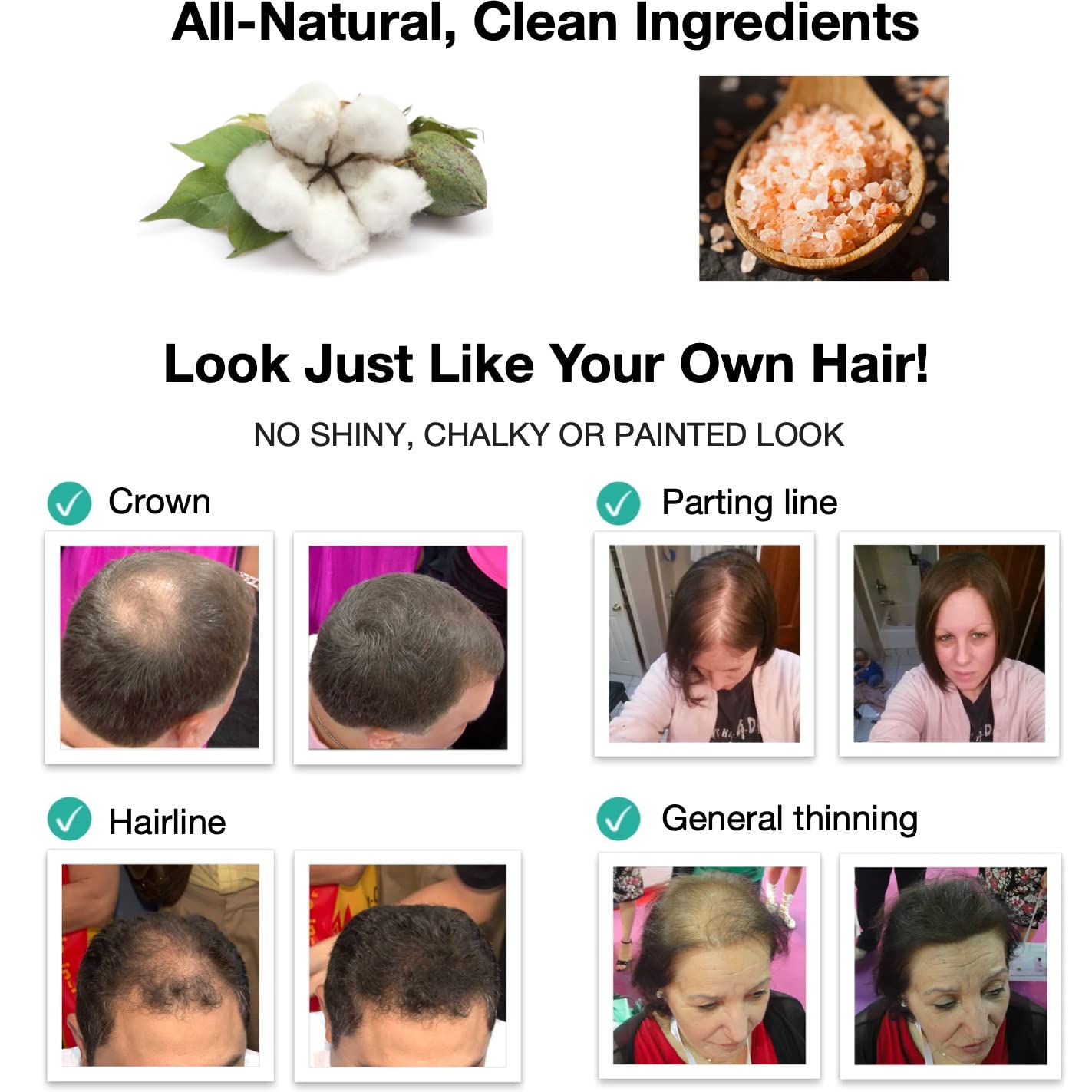 Oculta puntos calvos y bordes calvos al instante. Haz que el cabello fino se vea 10 veces más lleno. Kit de inicio de fibra capilar Caboki (negro)