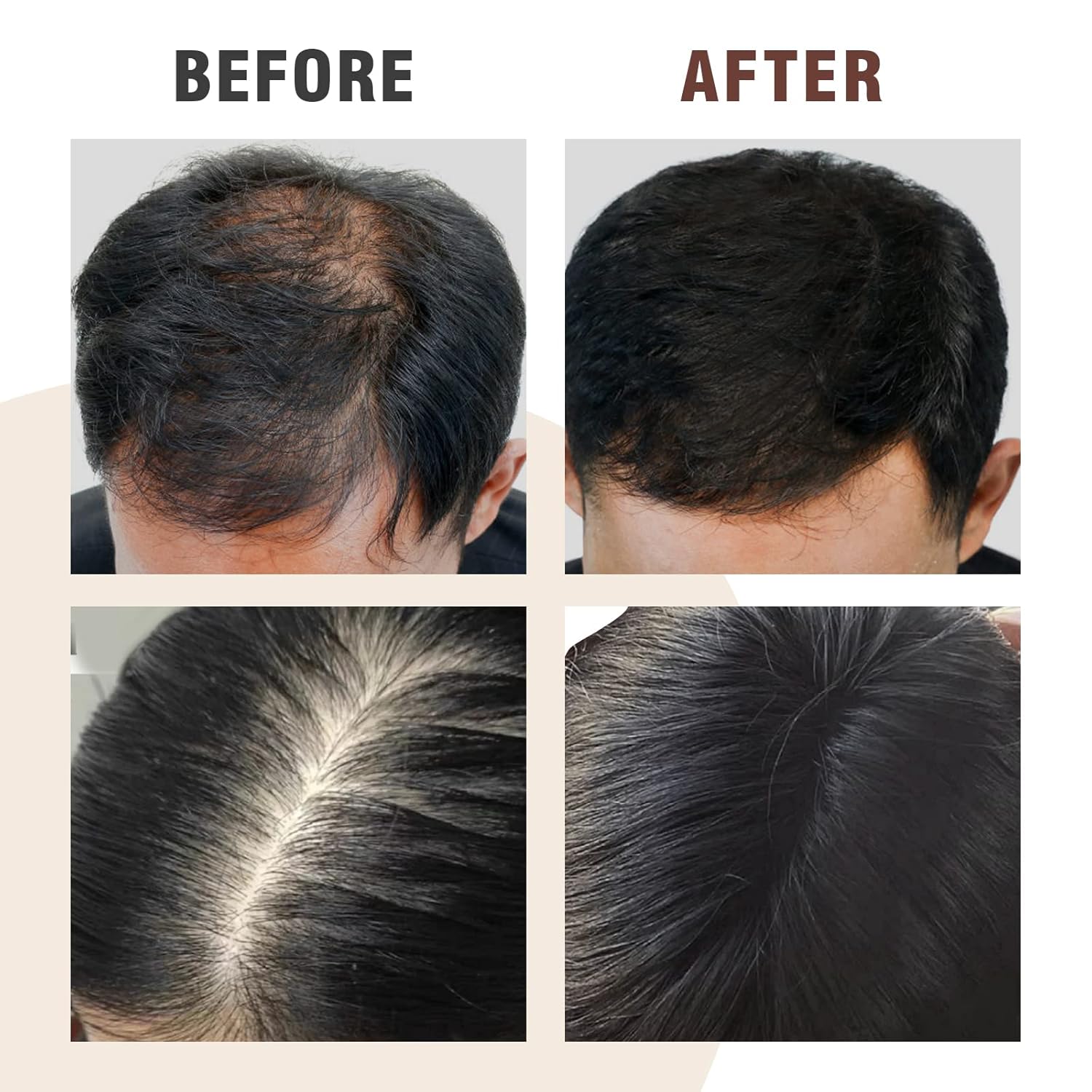 Champú para adelgazar el cabello 5 en 1, lavado de cabello orgánico 100% natural infundido con jengibre, ginseng, Polygonum Multiflorum, tratamiento