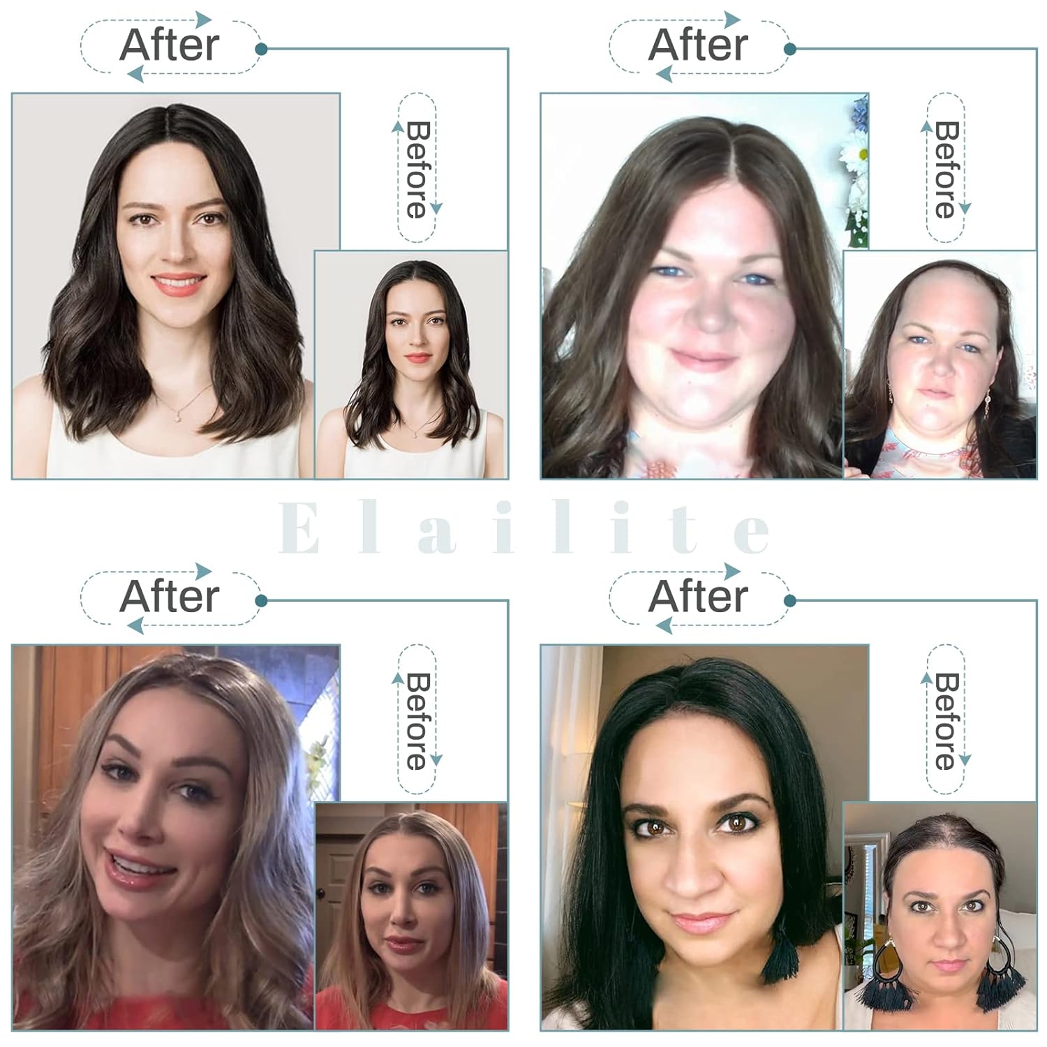 Elailite Toppers de cabello humano para mujer con clip de cabello fino V3.0, piezas de cabello real de 12 pulgadas con raya media para pérdida de