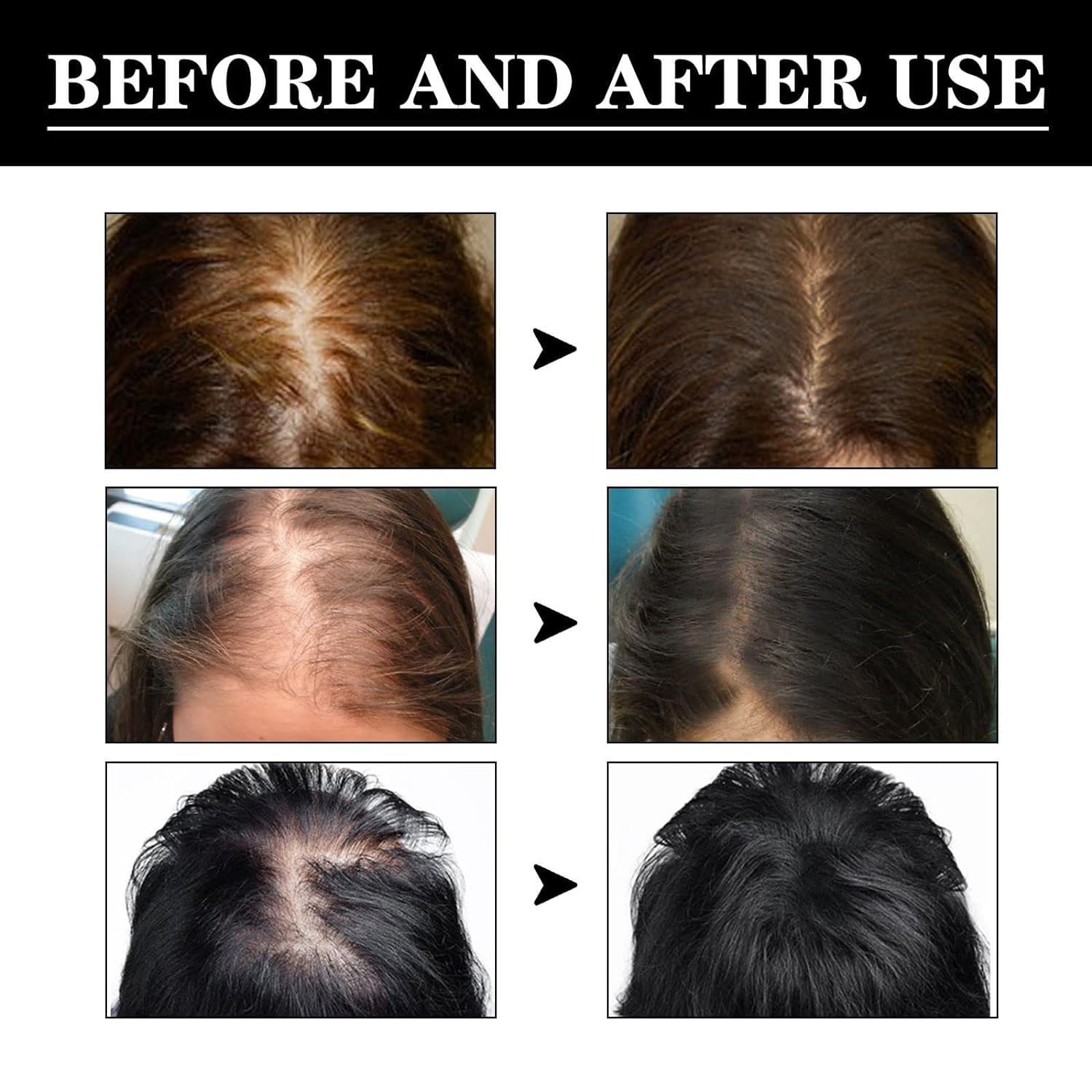 Suero para el crecimiento del cabello, aceitunas africanas, suero para el crecimiento del cabello, suero de amor para el cabello, aceite para