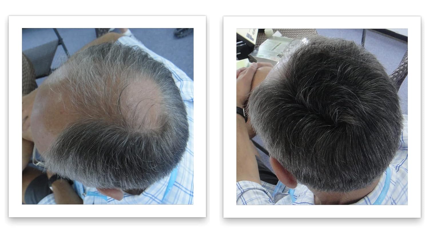 Tamaño de prueba elimina el punto calvo y el adelgazamiento del cabello al instante. Haz que el cabello fino se vea 10 veces más lleno. Fibra