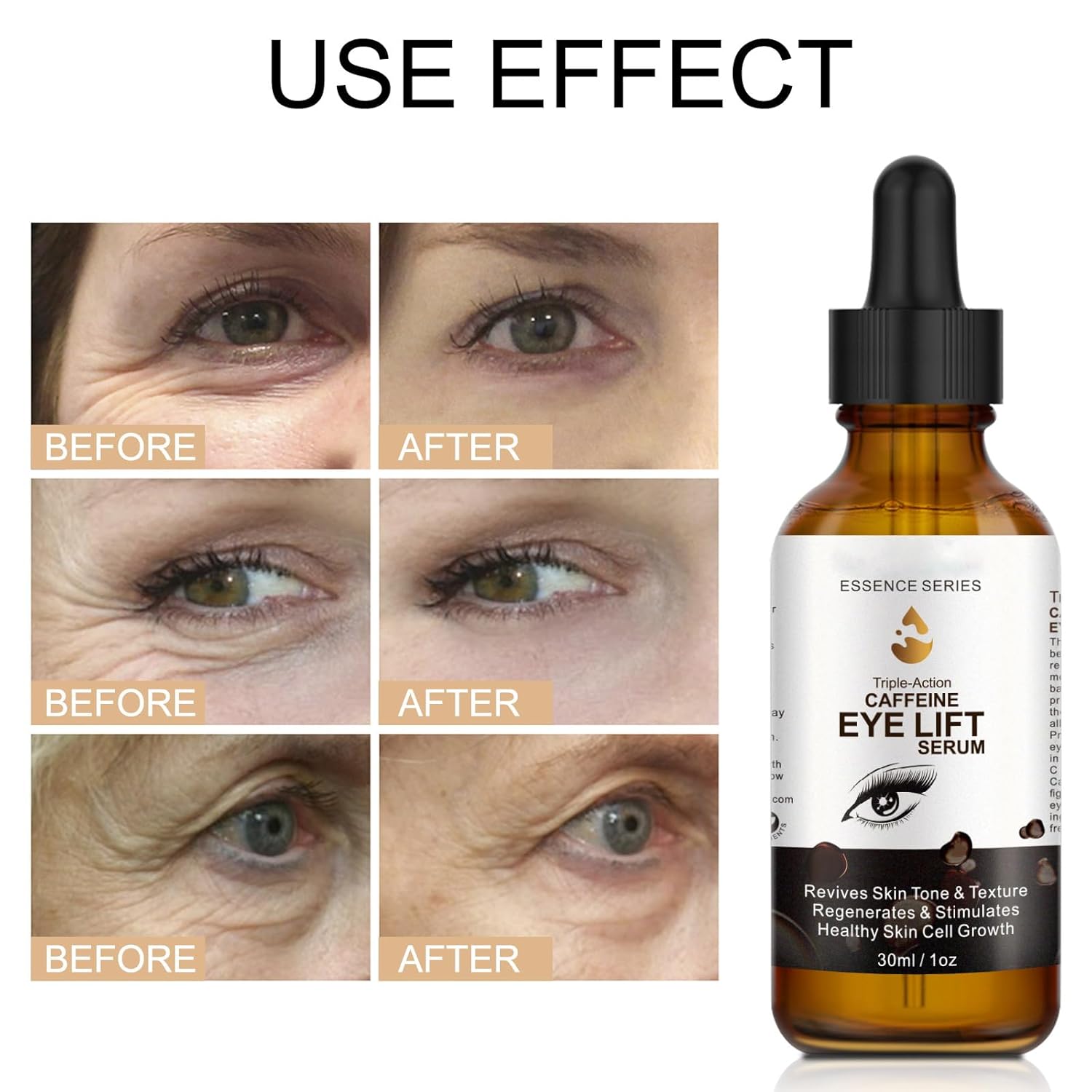 Suero de ojos con cafeína, antienvejecimiento para ojos y cara, suero de cafeína para levantar los ojos, reduce la hinchazón, las ojeras, las bolsas