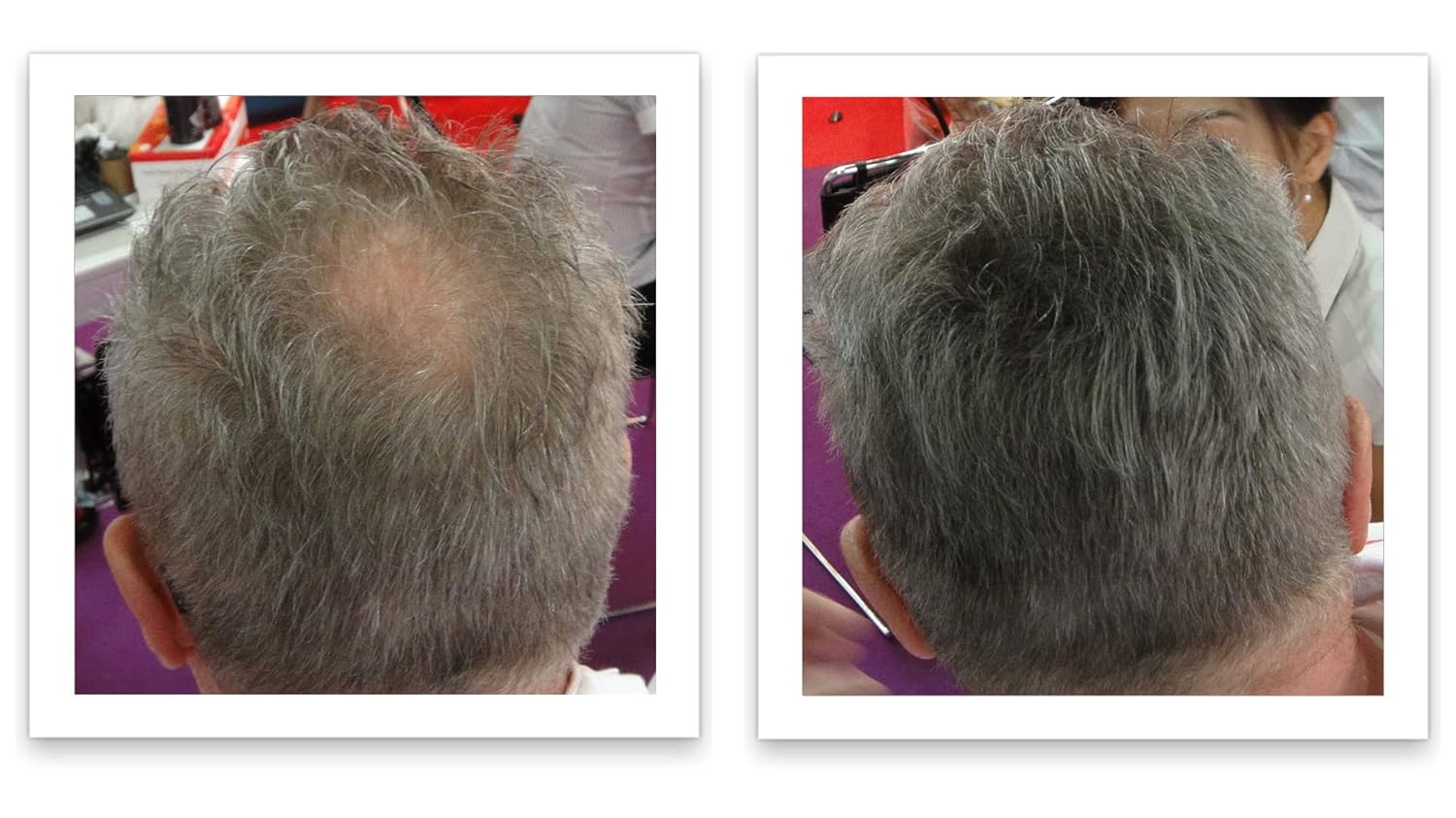 Tamaño de prueba haz que el cabello fino se vea 10 veces más lleno. Elimina el punto calvo y el adelgazamiento del cabello al instante. Corrector de
