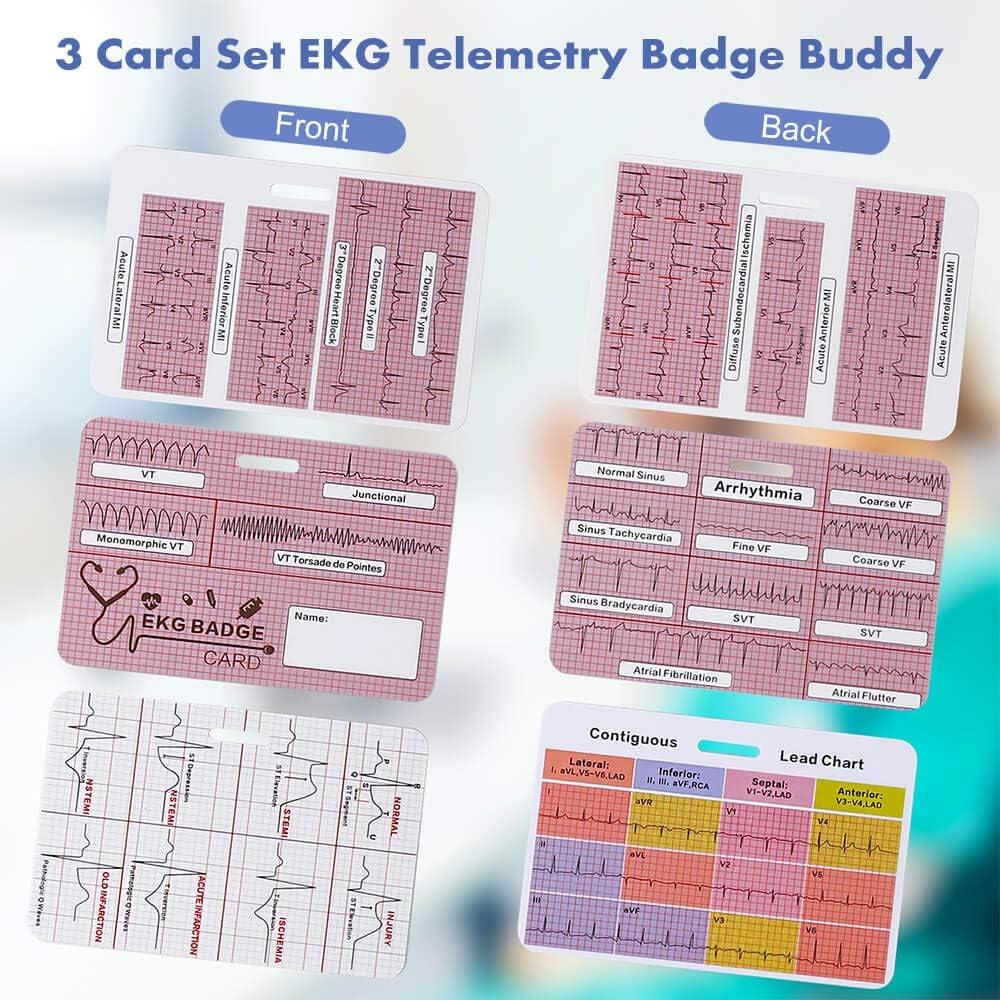 EKG – Juego de 3 tarjetas de identificación cardíaca, tarjeta de identificación Stemi, tarjeta de interpretación de telemetría de ECG, amigo de