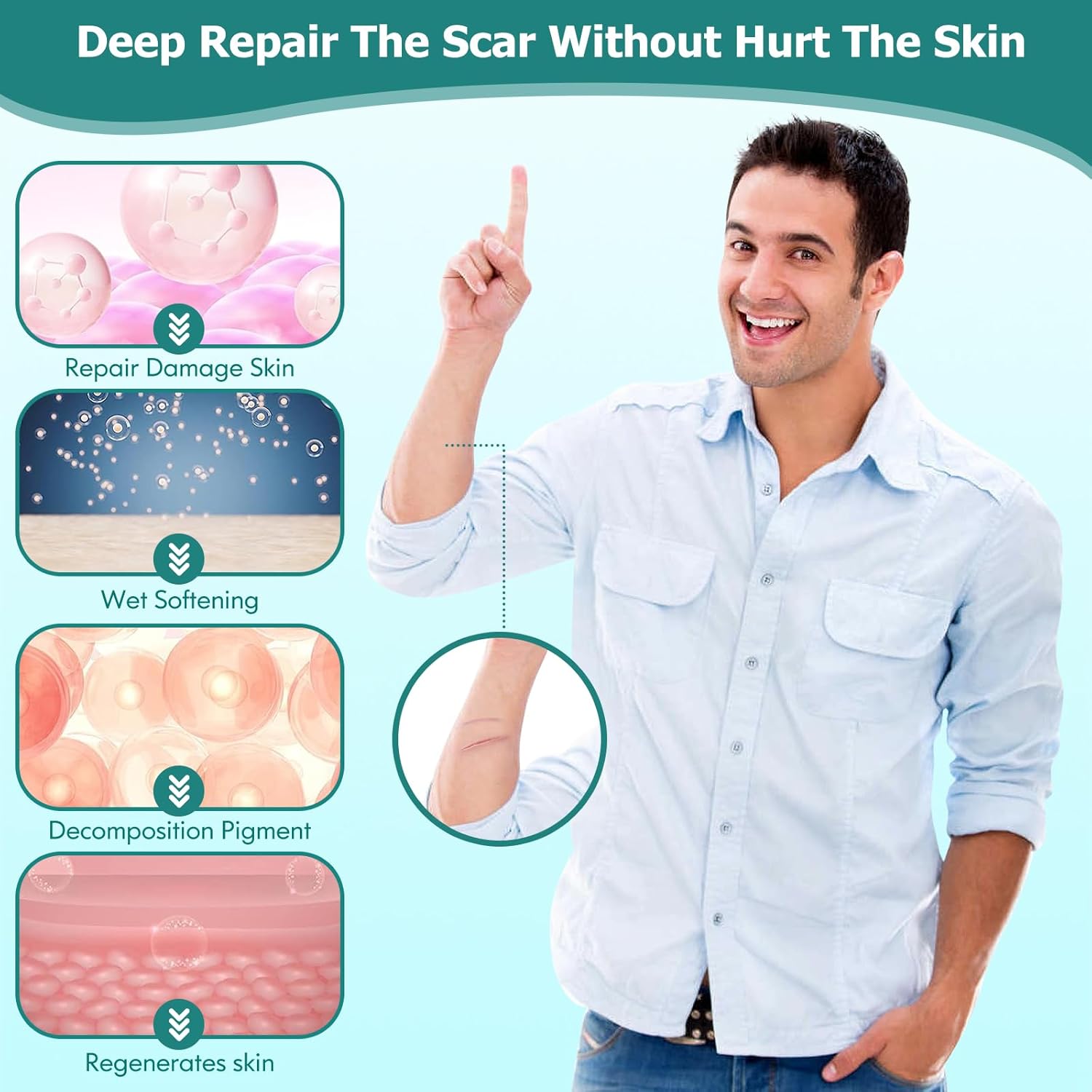 Gel de cicatrices, crema para cicatrices, gel avanzado para cicatrices quirúrgicas, cara, cuerpo, pierna, quemaduras, aceno, cesárea, estrías,