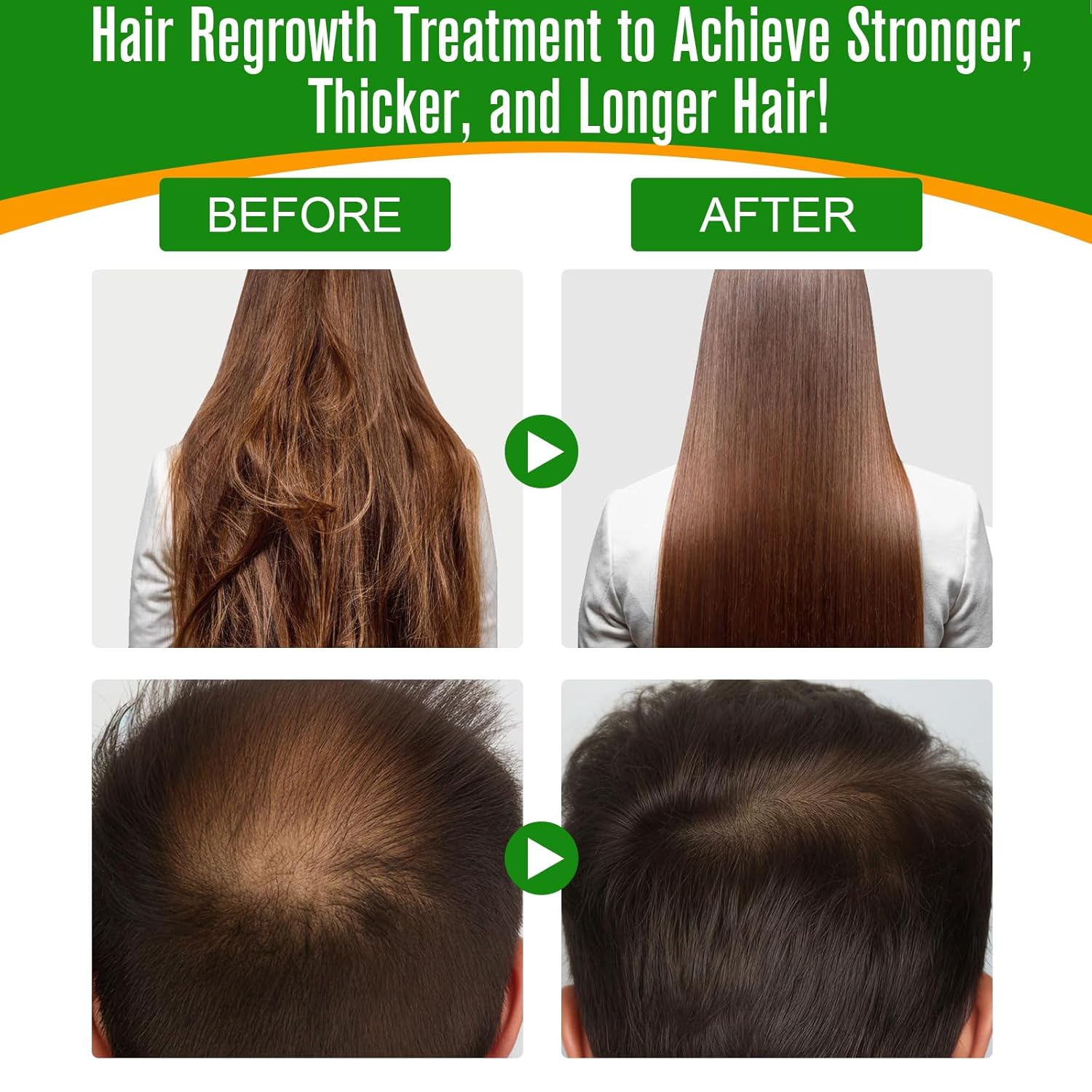 Aceite de batana para el crecimiento del cabello, aceite de batana 100% crudo para el crecimiento y la nutrición del cabello promueve el bienestar