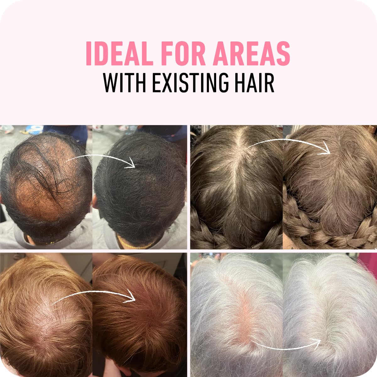 BOLDIFY – Fibras de pelo para el cabello fino (rubio claro), indetectables, botella de 2 onzas oculta completamente la pérdida de cabello en 15