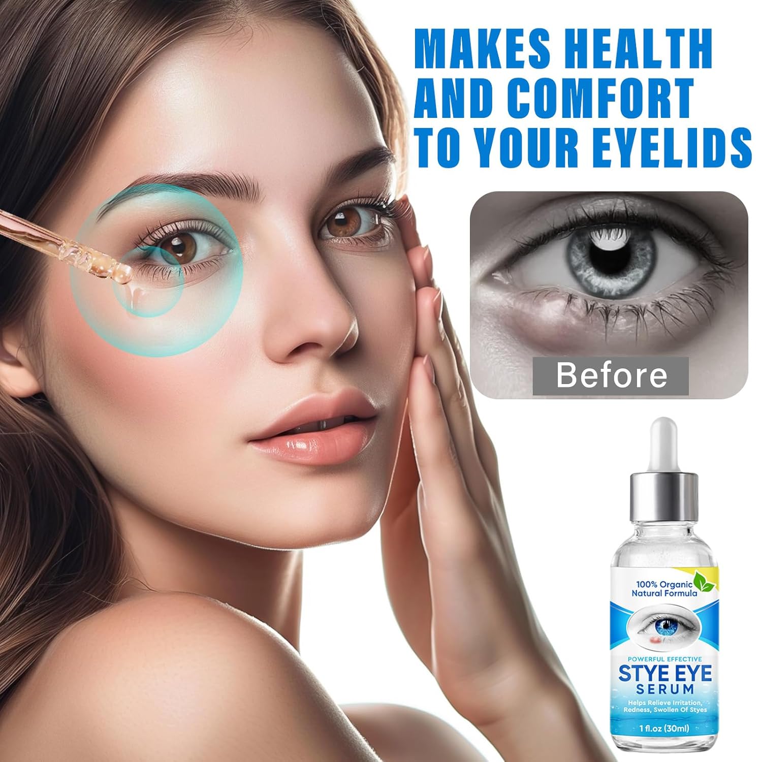 VERYCOZY Tratamiento de ojos de orzuelo, alivio eficiente para los ojos de orzuelo para tratamiento de blefaritis y calazión, suero de alivio de
