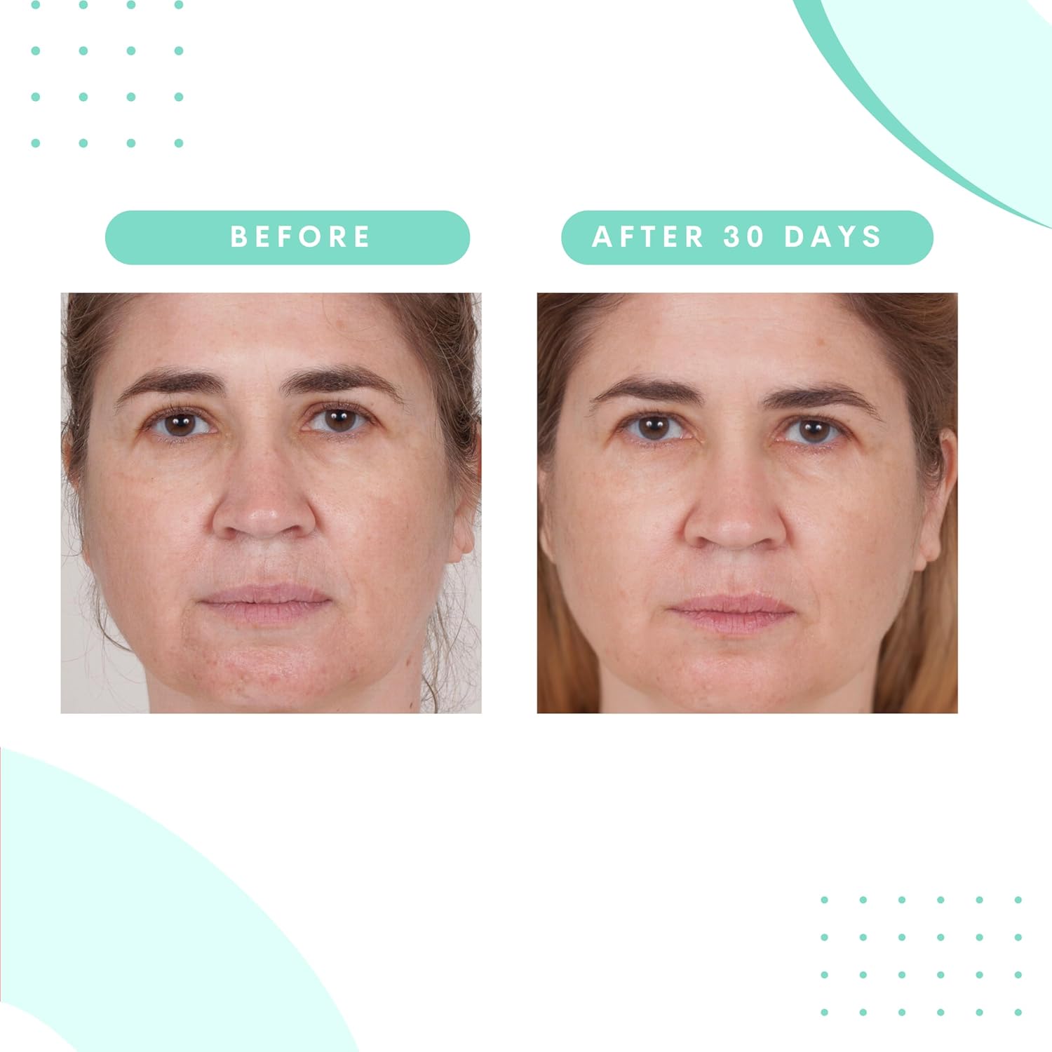 Serious Skincare – Almohadillas faciales de rejuvenecimiento glicólico para una piel más suave – Ácido glicólico – Exfolia las células muertas de la