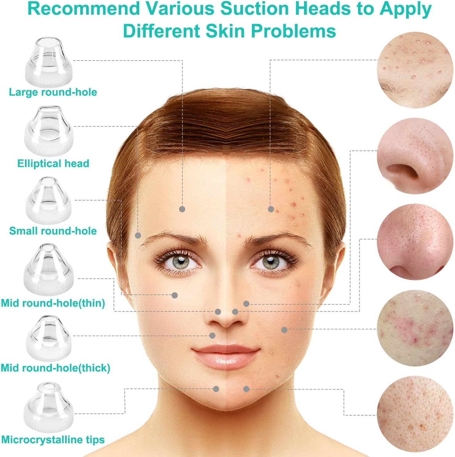 Aspiradora eliminadora de puntos negros, limpiador eléctrico de poros facial 2021, herramienta extractor de acné recargable por USB, kit de