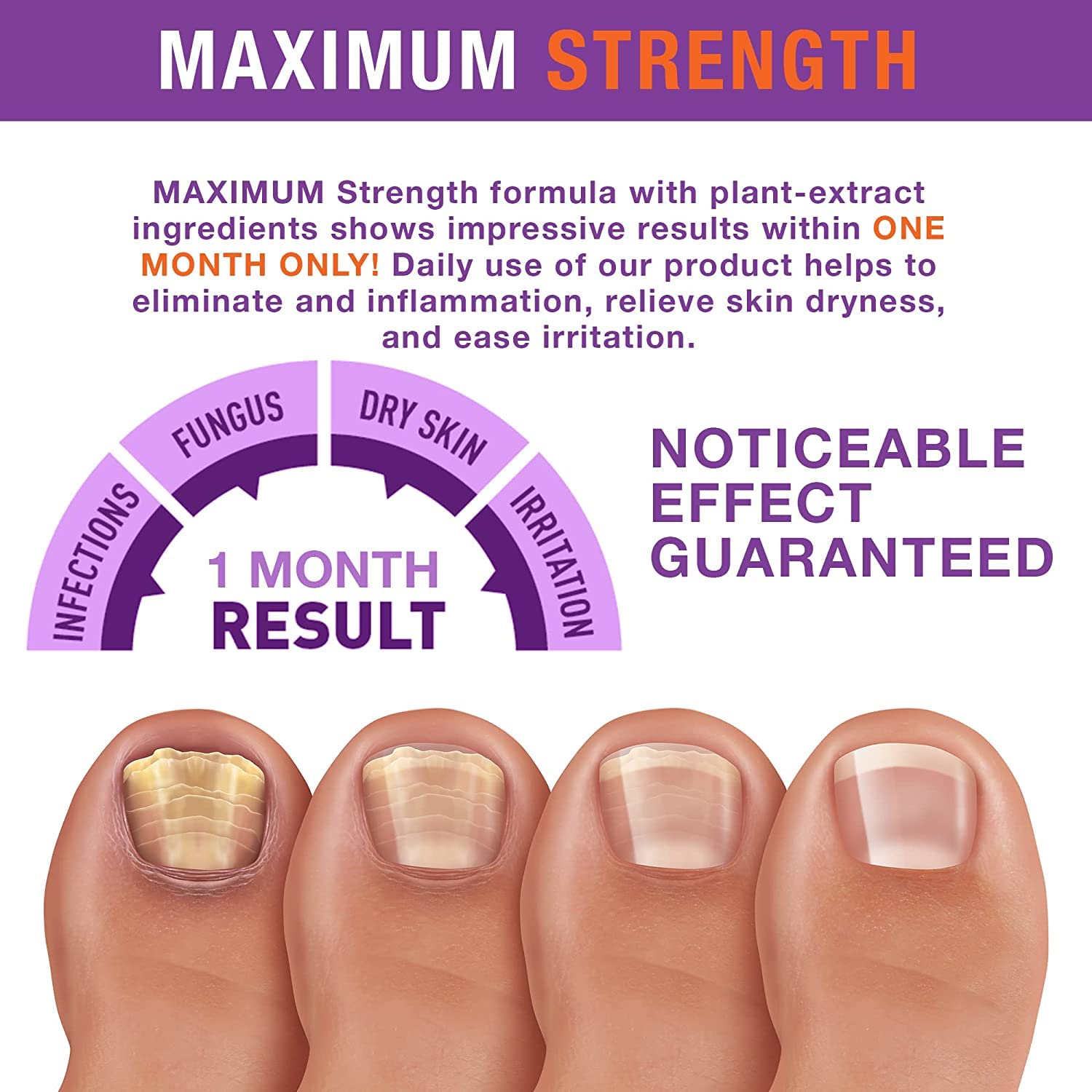 Tratamiento de hongos en las uñas de los pies y las uñas finas, tratamiento de hongos en las uñas de los pies, extra fuerte, tratamiento eficaz de