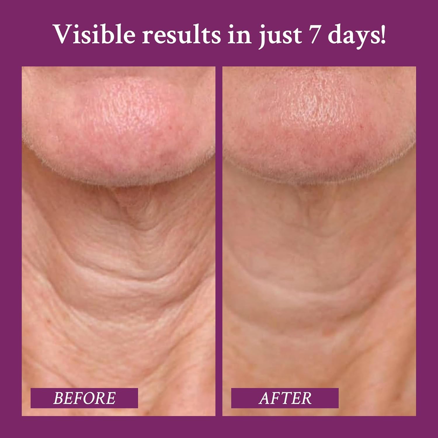PRAI Crema para el cuello para tensar y reafirmar la belleza  Crema reafirmante para el cuello que aumenta la elasticidad  Crema para tensar el